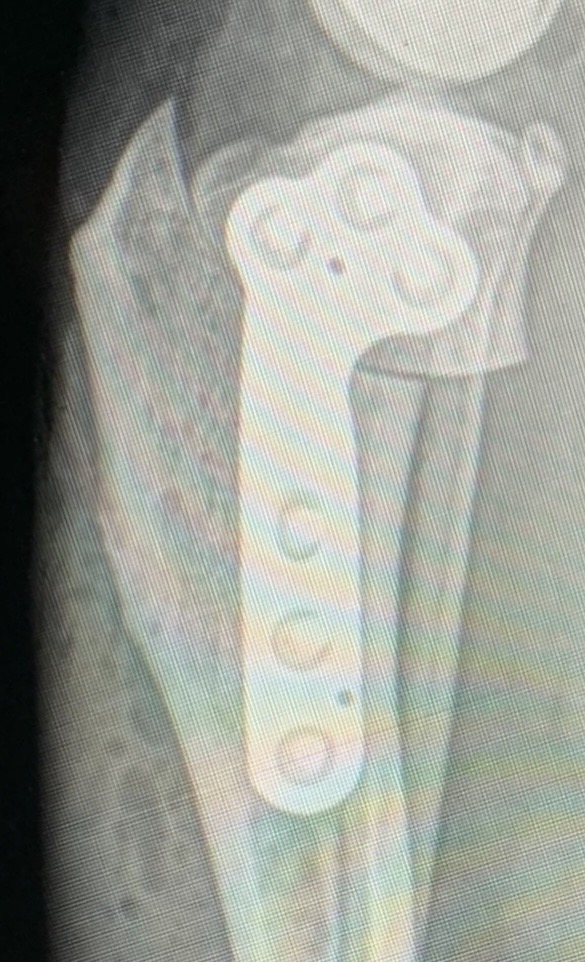 x-ray image