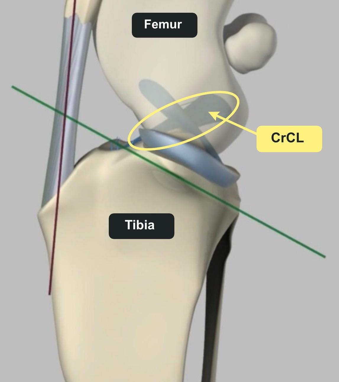 a diagram of a knee joint