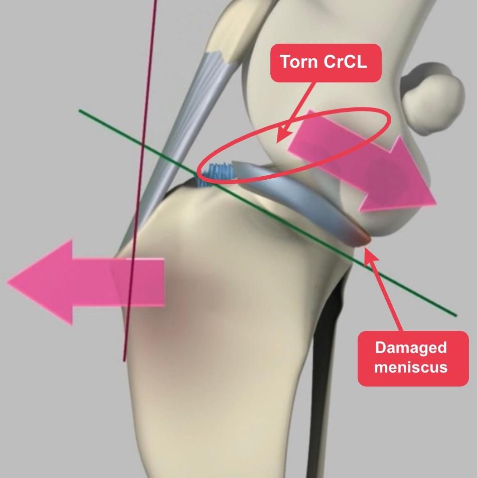 a diagram of a broken knee